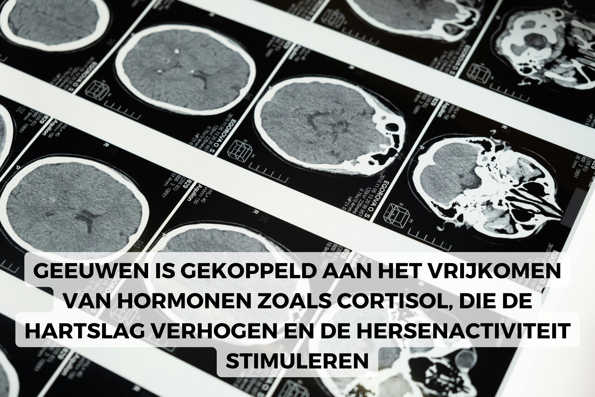 gapen cortisol